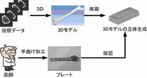 内固定材成形支援システムの開発(H18)の画像2